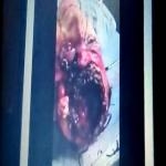 Cadaver